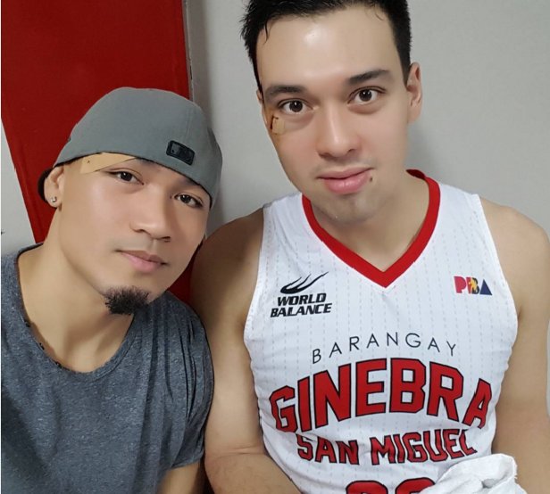 MBDODP's tweet photo. LOOK | #MarkCaguioa, #GregSlaughter ‘thank’ Ginebra teammate #JapethAguilar for stitches https://t.co/Bff7RcTUtZ https://t.co/7ZmOpmkjQd