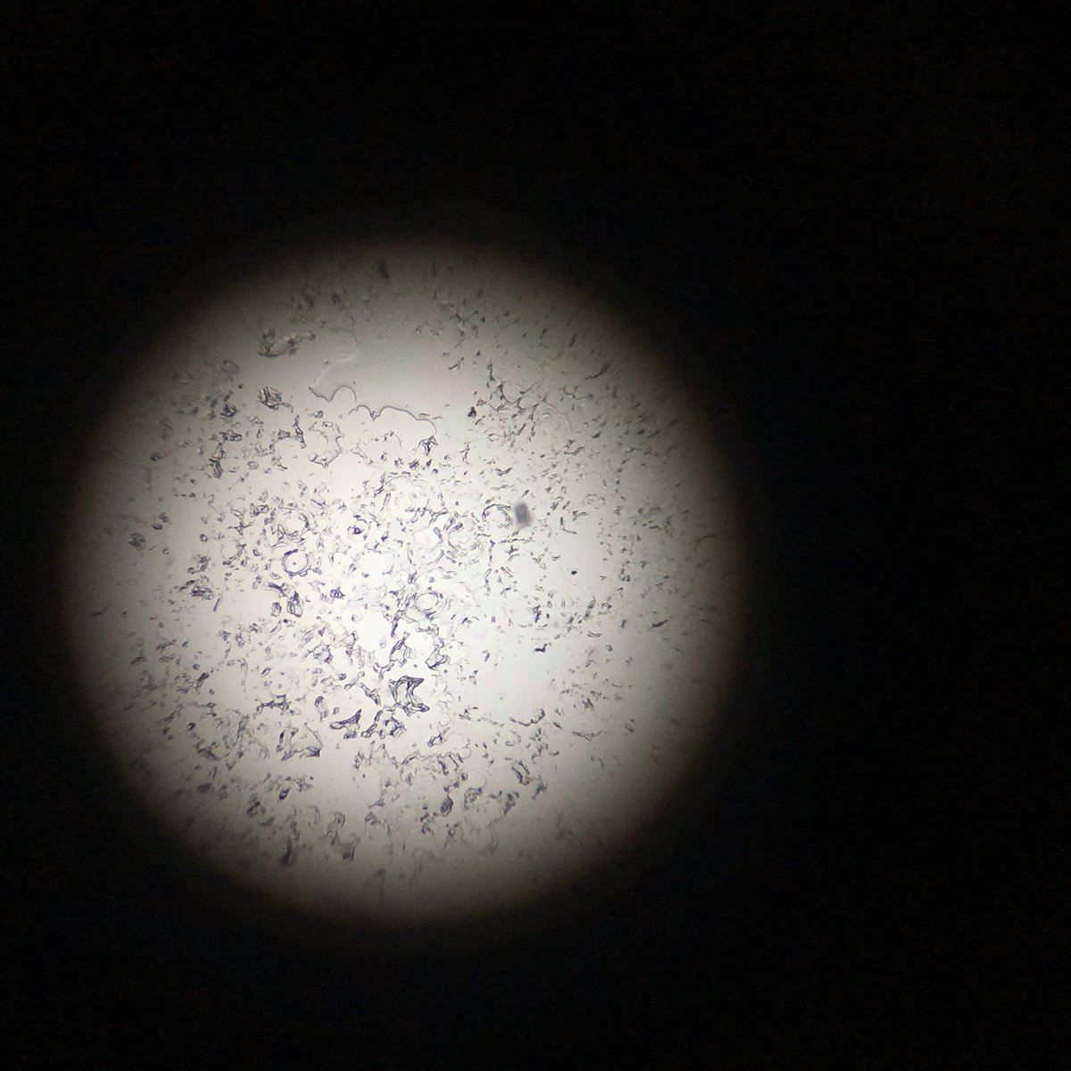 ScienceRamsey's tweet photo. Mrs Cook's Y10 class comparing the top and underside of a leaf for stomata #biology #microscopes #stomata https://t.co/sfnIfYStZd