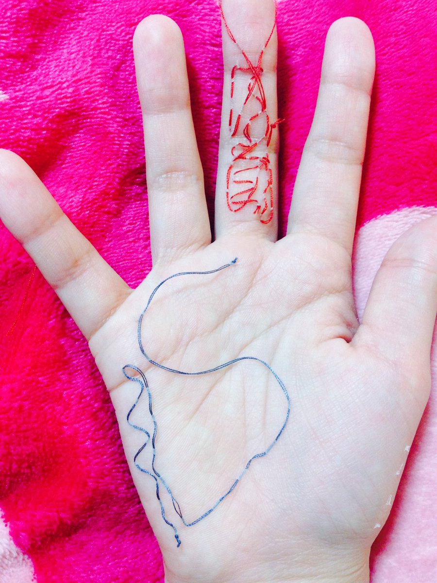 ボディステッチ