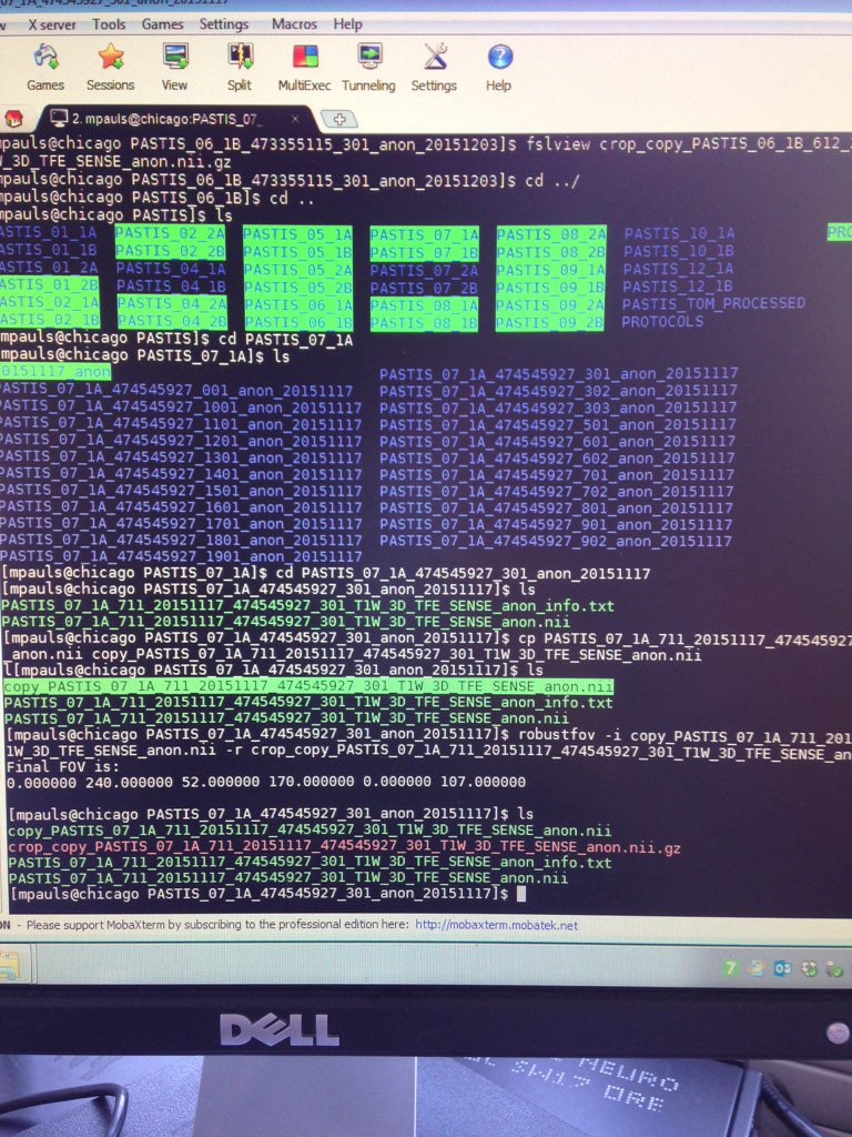 mathildepauls's tweet photo. Can barely contain my excitement about doing this stuff... #LimitedAttentionSpan #LoveComputers. Not. https://t.co/Iwrpoawgwz