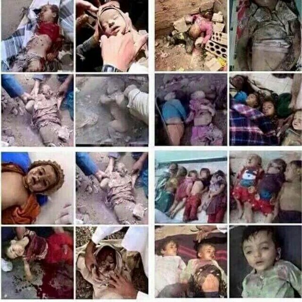 poissonbordeaux's tweet photo. AGGRESSION WAR AGAINST YEMEN IS A CRIME AND VIOLATES THE SOVEREIGNTY OF YEMEN. THOUSANDS CIVILIANS MASSACRED... https://t.co/creBeqDQfE