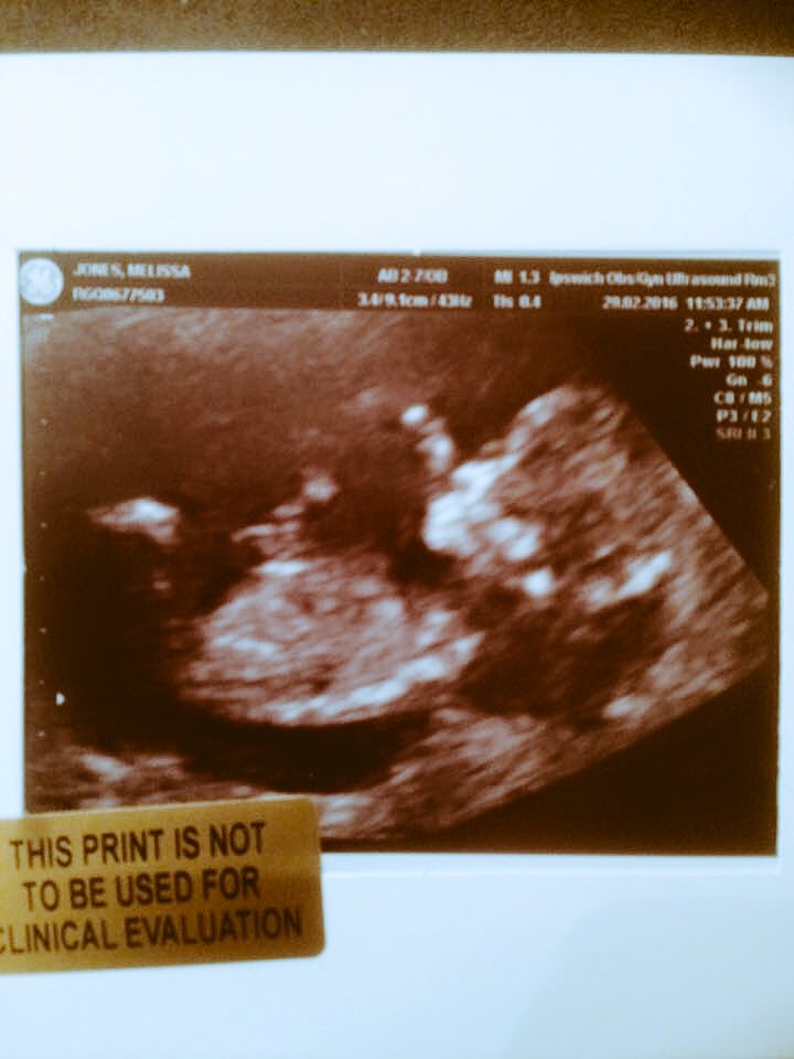 BoyceAshley's tweet photo. I'm going to be an uncle 🎉🎈😍🎉 https://t.co/Y2q7cs47Dx