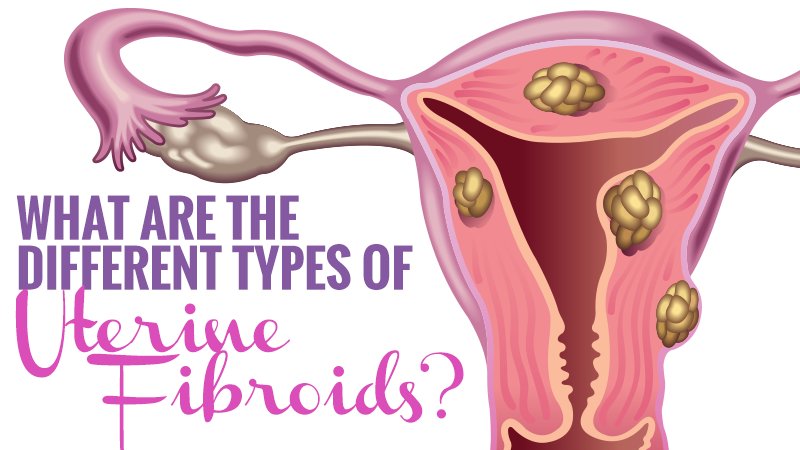 Georgia Vascular Institute tweet media