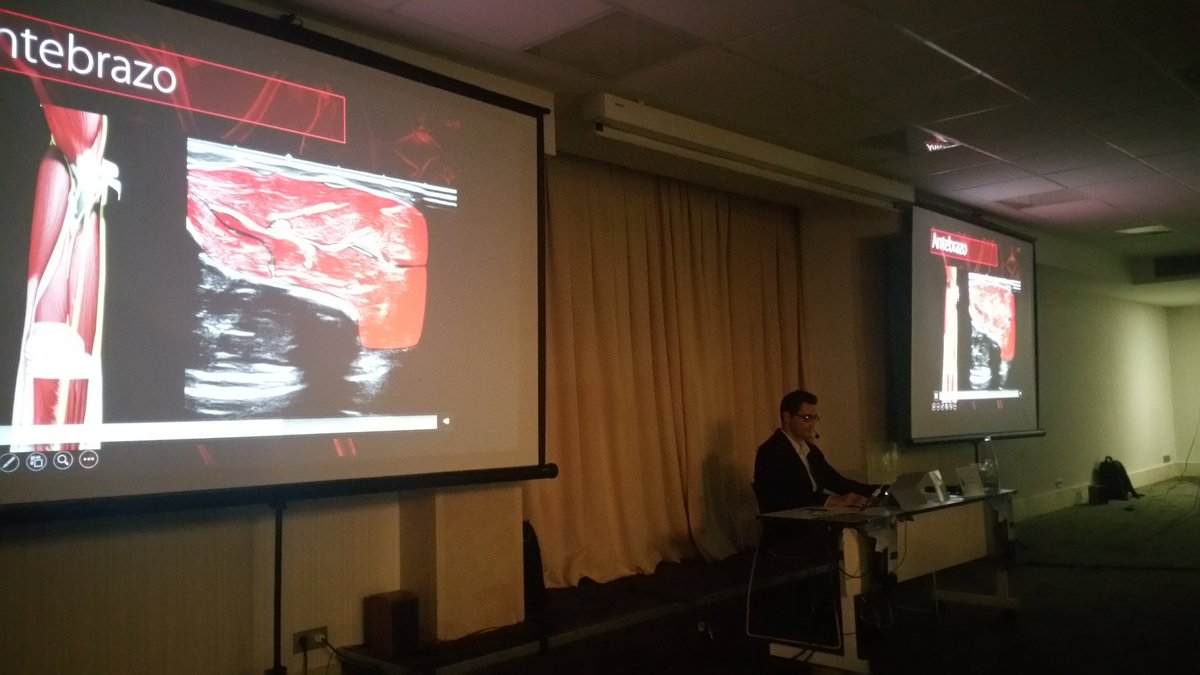 carlespedret's tweet image. Median nerve sonoanatomy @inigoiri #ECOARS