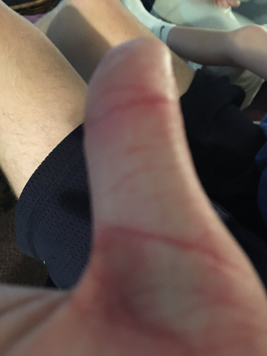 Builder_US's tweet photo. @WilkesClunan is questionable for tonight's game with a bruised thumb https://t.co/aLCzy53VIE