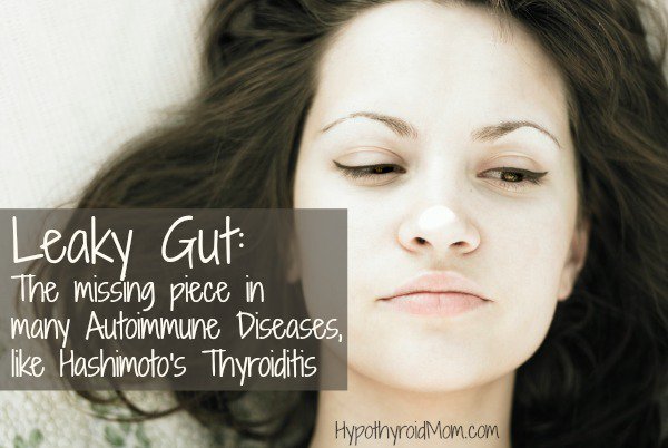 HypothyroidMom's tweet image. Leaky Gut: The missing piece in many Autoimmune Diseases, like Hashimoto's #autoimmune bit.ly/1GofIwc