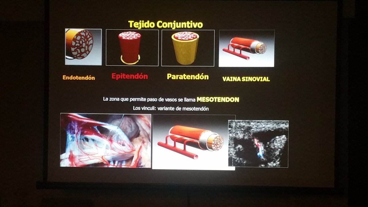 carlespedret's tweet image. Connective tissue tendon components. #ECOARS Dr. Joaquín Lemos
