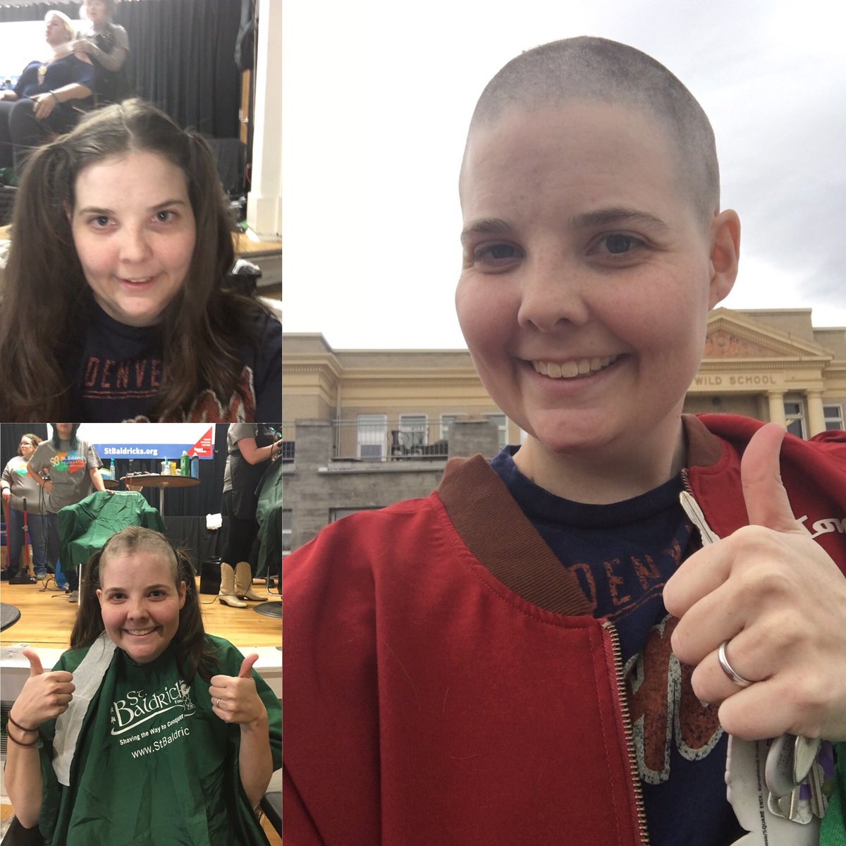 Ask me why I'm bald? #stbaldricksfoundation #childhoodcancerawareness