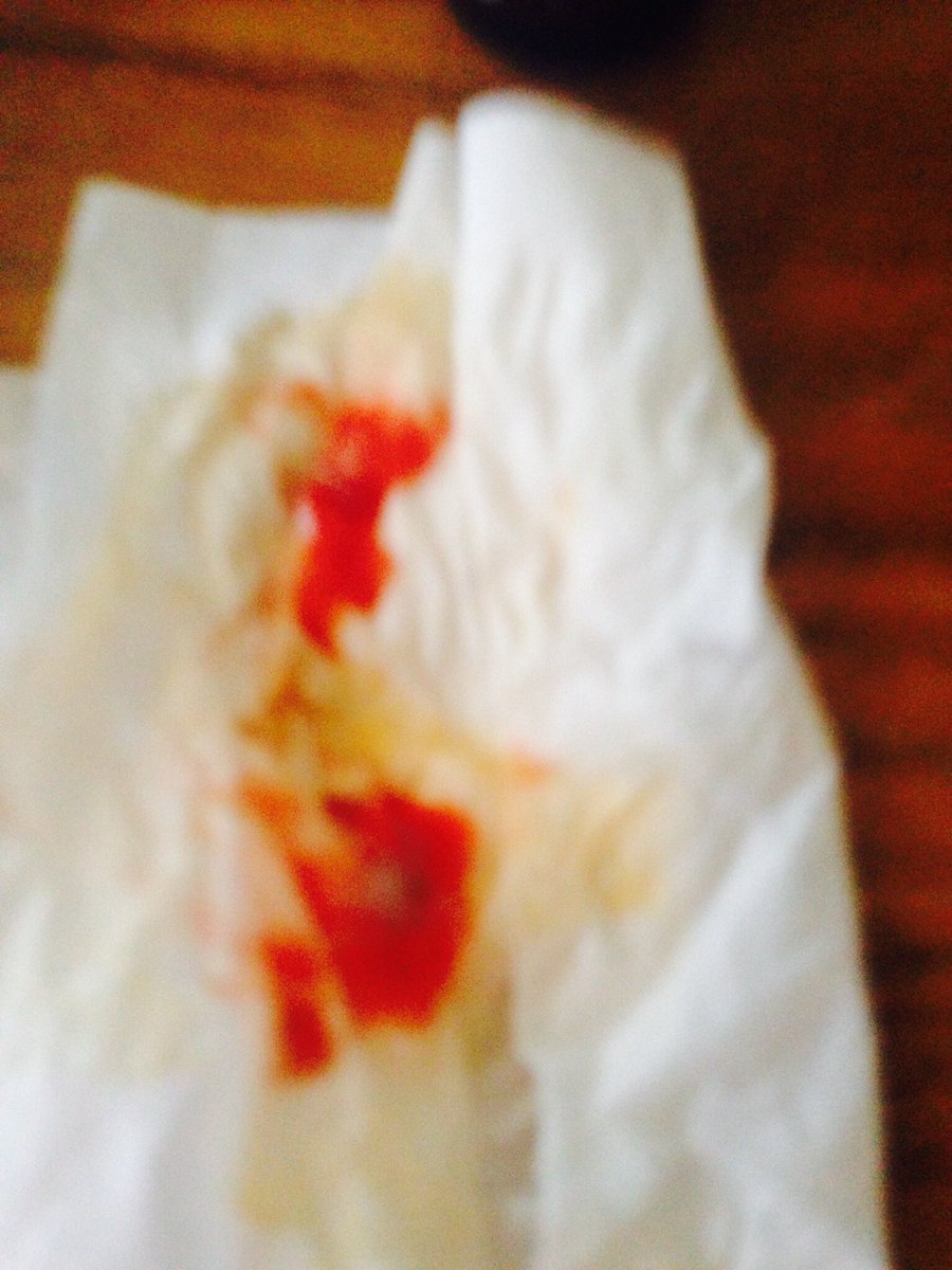 LisaTasker1's tweet photo. @VZWSupport while phone was gone  as ive got a wife. Broke back me just diagnosed lung cancer coughed up this AM https://t.co/Rv6zEnr6iB