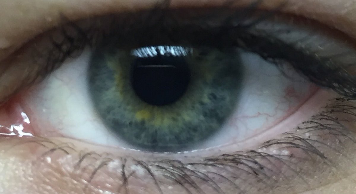 Vanij Klein (@vanij_klein) on Twitter photo 