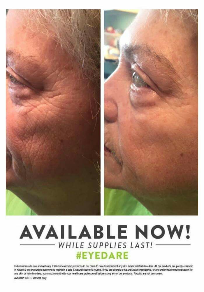 slimwraps4u's tweet photo. Isn't this amazing? 
Try it today at my cost!

#wrinkles #gone #tighterskin #turningclockback #backinguptime https://t.co/Lq8iP90icV