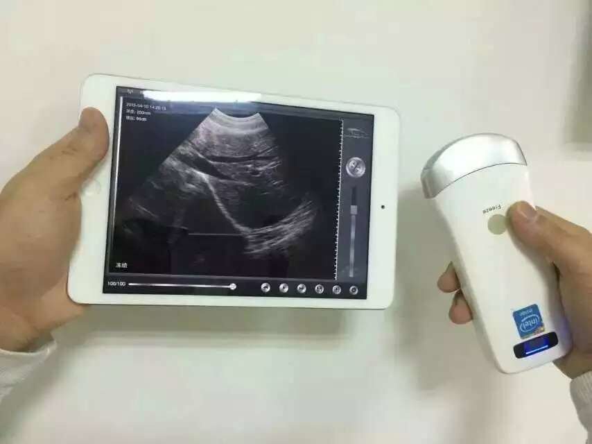 TonyUltrasound's tweet photo. @AIUM_Ultrasound Hi, Zac, how are you? do you need wireless ultrasound? we send catalogs  attached, please check https://t.co/TDidUp2R9u