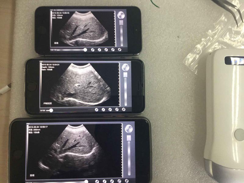 TonyUltrasound's tweet photo. @apksorg Our wireless probe ultrasound scanner, do you like? https://t.co/O5FnGRLJS2
