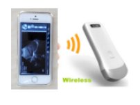 TonyUltrasound's tweet photo. @PompousItems our wireless ultrasound scanner, do you like? https://t.co/OTM9SAqXfK