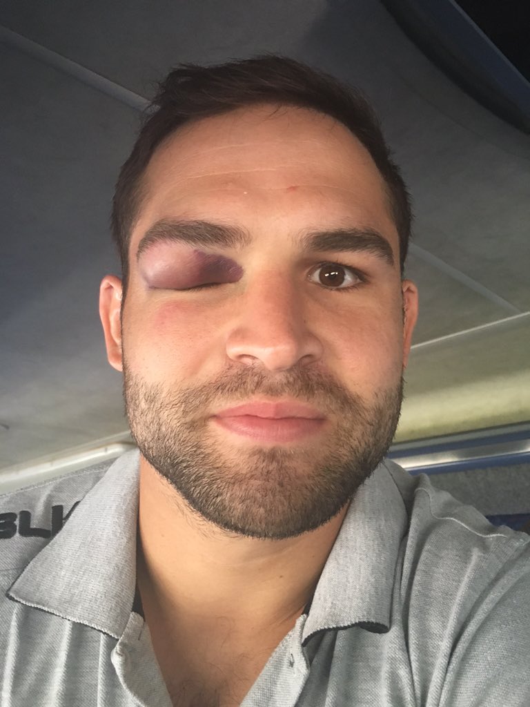 Fizzioshark's tweet photo. @c_reinach @TheSharksZA Would love to see the other guy Cobieππ#stopwinkingatme! https://t.co/0b0VdwV5Ol