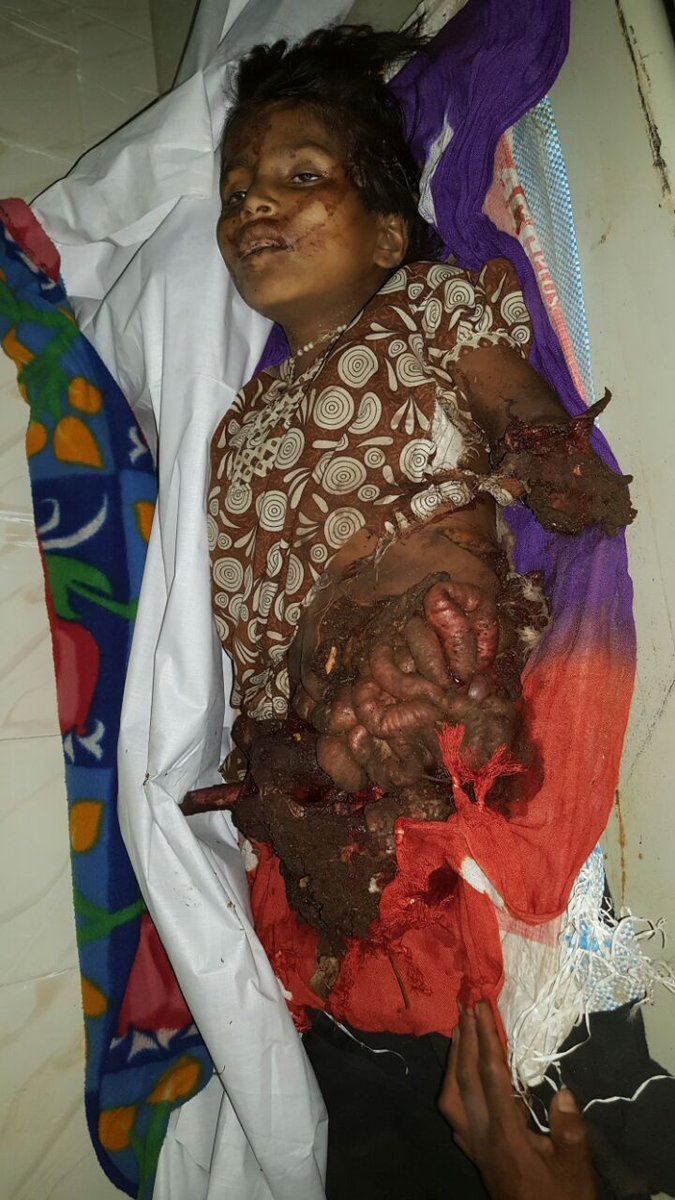 HindolSengupta's tweet photo. Body of the girl who was torn to pieces by Maoist IED. This is the revolution that some 'students' seek. https://t.co/Kka5Pe2xMz