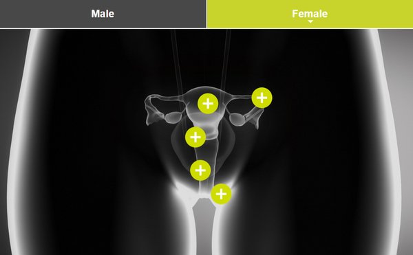 BoltBurdonKemp's tweet image. Our interactive guide aims to raise awareness of #reproductivecancer, find out more here - goo.gl/yvr9R4