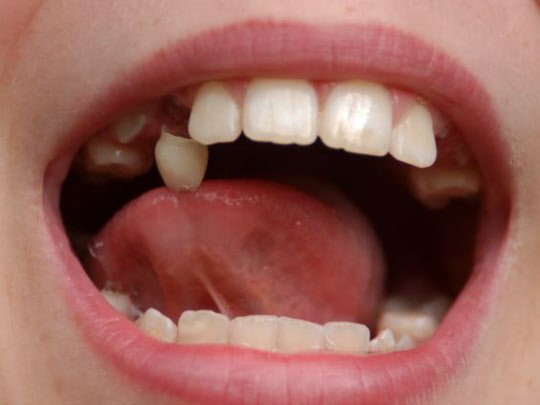 [한국에선 불길한 '이 빠지는 꿈', 서양의 해몽은…]
보통 하루 밤새 꾸는 꿈은 4~6번. 다만 깨고 나서 많은 경우, 기억하지 못할 뿐이다.
blog.donga.com/zmon21/archive…