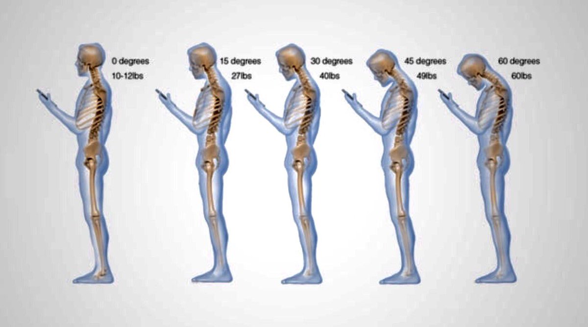 @bodytonicUK you must see this posture all the time! #postureawareness #mobilephoneuse