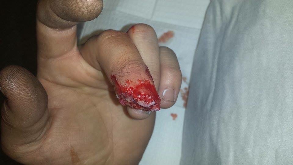 timtwigg's tweet photo. Ouch https://t.co/h1bHfLGX0D