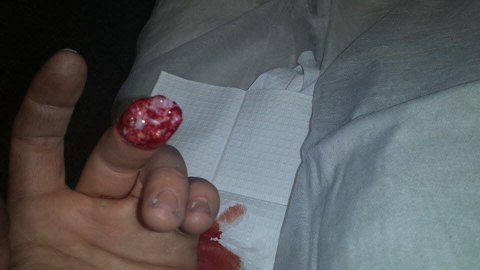 timtwigg's tweet photo. Ouch https://t.co/h1bHfLGX0D