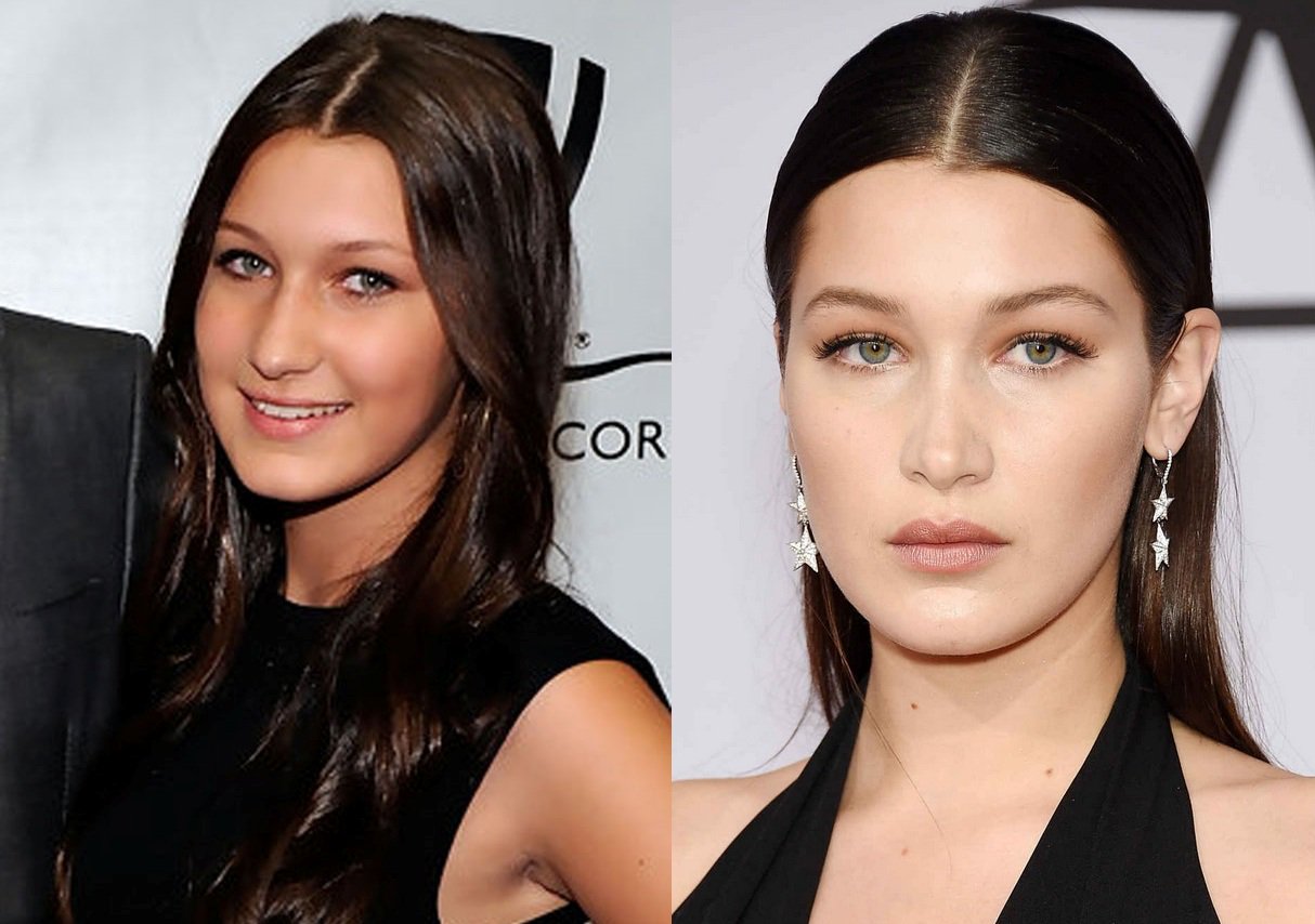 KEEP SMILING on Twitter: "Bella Hadid before and after the plastic surgery #nose #lips # ...