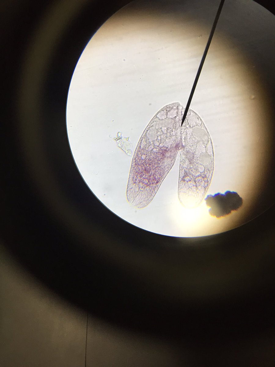 msstern_lhs's tweet photo. Blepharisma conjugation! #ballhr6 @msball_lhs https://t.co/ulhVyuEIy8