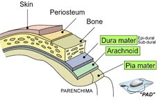 imindmaps's tweet image. "PAD" a mnemonic to remember the meningeal layers. P of Parenchima and Pia, Arachnoids, Dura. #USMLE #meded #Step1