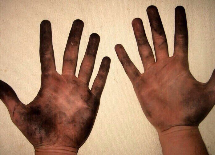 nicesamreinhart's tweet photo. Apparently this is a picture of my hands. It can't be real because I wash my hands often so others don't get sick. https://t.co/7szZfqBcZv