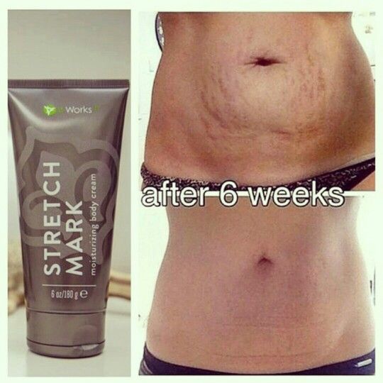 ChelseaKWraps's tweet image. whos ready to to get rid of those stretch marks? order our awesome stretch mark cream here: chelseakwraps.myitworks.com/shop/product/C…