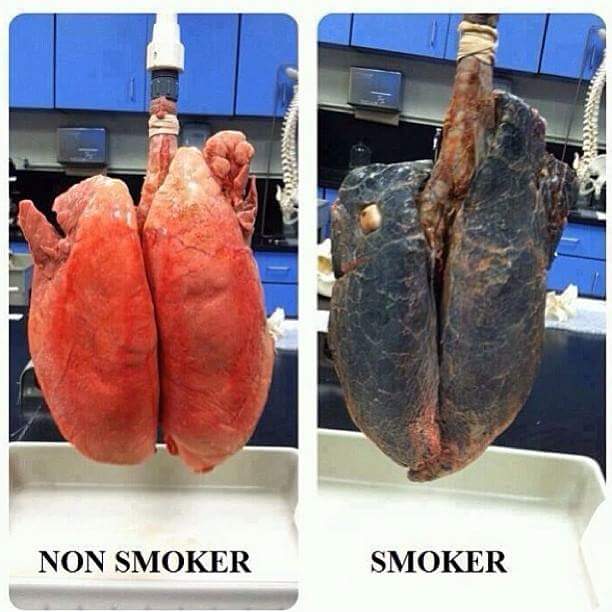 HynekHazel's tweet photo. Maybe this explains why I don't want students smoking? #RealLungs #StopSmoking #Vocalist  #HynekTrainingStudios https://t.co/4i0UkPvIcY