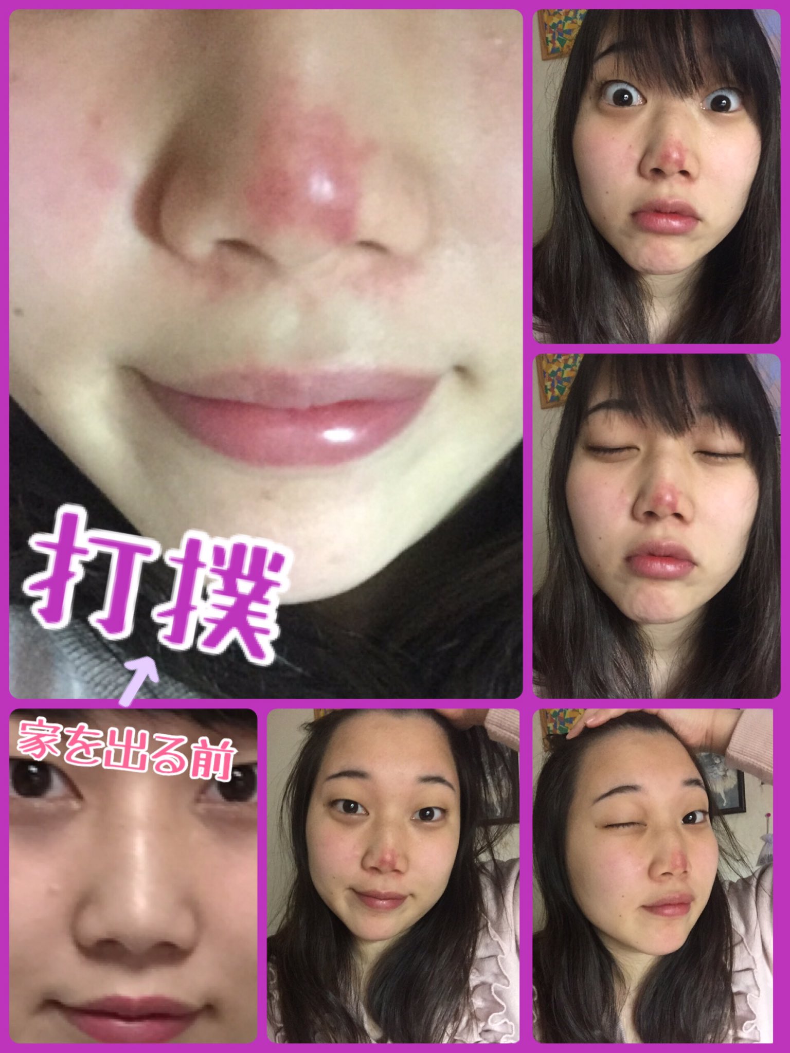 エレガント人生 祥子 Twitter પર 今週の芸人同棲です 何事も経験を積まなくてはならないのだと 思い知らされました T Co Pwgfoby1mp お外ではしゃいでいたら お鼻と頬を打撲しましたが 祥子は元気です T Co 8nlay0vjkv エレガント人生 祥子 Twitter પર 今週の芸人同棲です 何事も経験を積まなくてはならないのだと 思い知らされました T Co Pwgfoby1mp お外ではしゃいでいたら お鼻と頬を打撲しましたが 祥子は元気です T Co 8nlay0vjkv