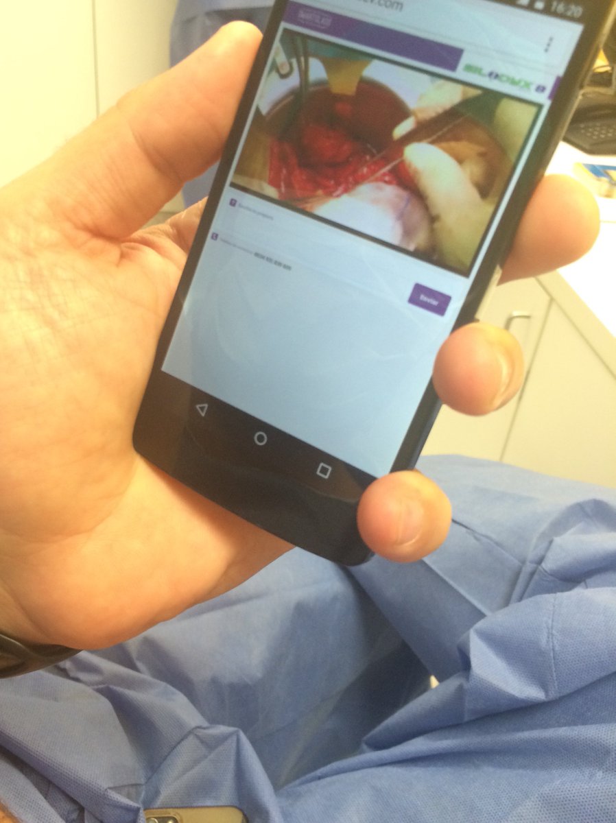 SmartglassExp's tweet photo. Excelentes resultados #retransmisón en directo #smartglass #transplante #riñón en tu #smartphone #tablet #ordenador https://t.co/4PeKow3IJA