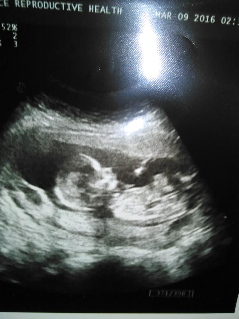 chavezmami520's tweet photo. #monster #4 #prego #momlife https://t.co/nA8vnhGqda