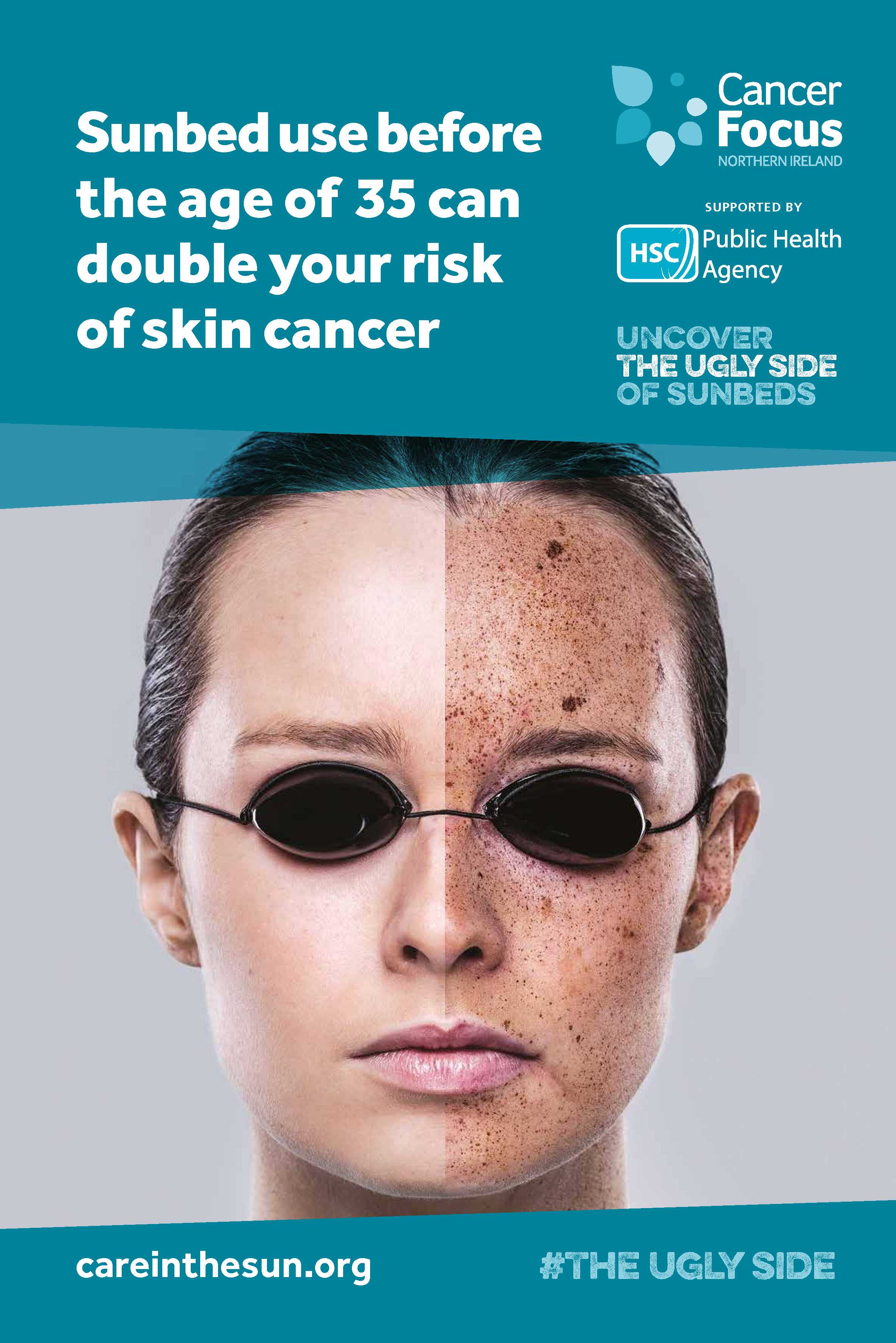 Public Health Agency on Twitter "Sunbeds are a surefire way to damage
