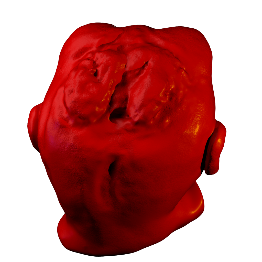 ValerioRizzo_'s tweet photo. #First #photogrammetrical #high-res #3D #reconstruction of #anencepghalic #phoetus @ Museum of Pathological Anatomy https://t.co/4LloFFLJe2