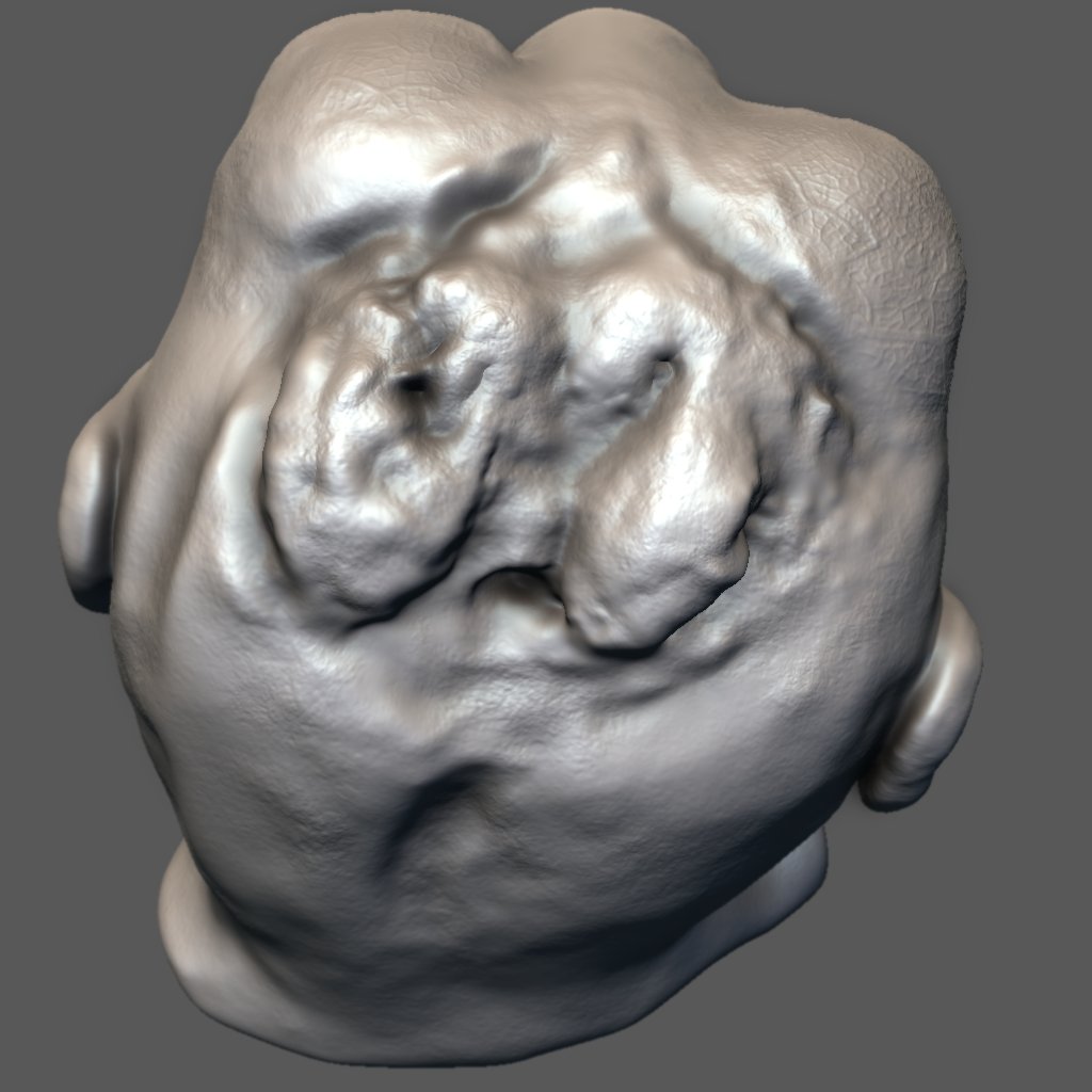 3DTAM_EU's tweet image. #First #photogrammetrical #high-res #3D #reconstruction of #anencepghalic #phoetus @ Museum of Pathological Anatomy
