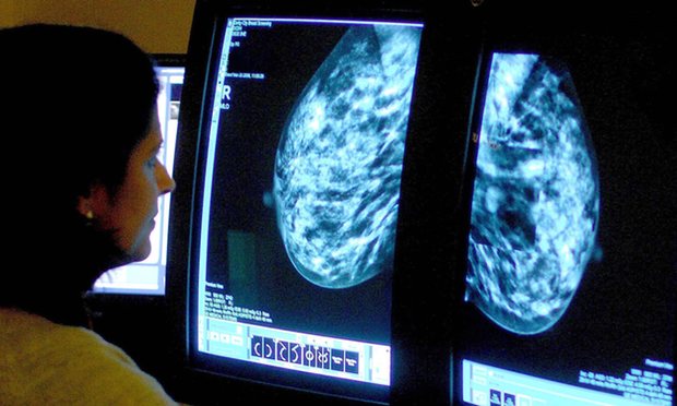 Latest #breastcancer findings could lead to fewer women needing chemo bit.ly/1TRpk9m <a href="/guardianscience/">Guardian Science</a>