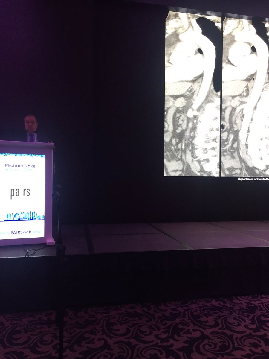 PAIRSannual's tweet photo. Dr. Dake presenting a case based discussion in: EVAR in challenging anatomy: landing zones and access #PAIRS2016 https://t.co/q2RN1JvVh2