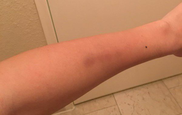 RattleTale's tweet photo. A bruise is a bruise is a bruise … and the smell reeks https://t.co/JGXFSY4xqq https://t.co/fU97EDNIVI