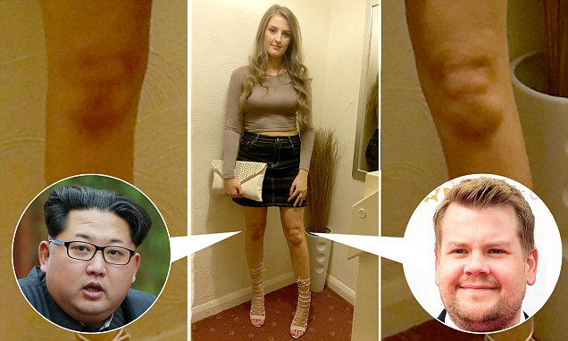 DailyMailUK's tweet photo. Do your knees resemble someone famous? Tweet us a picture! 😂 https://t.co/5usQKhPdf3 https://t.co/xcSvhhC6IP