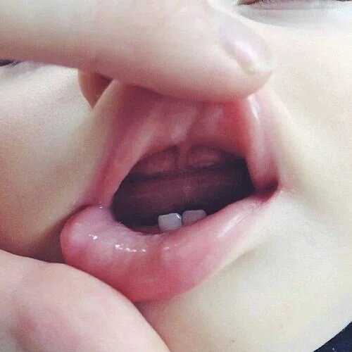 brooklnvx_'s tweet photo. Zähnchen sind fast alle da.💕 https://t.co/B6mCmf6YY4