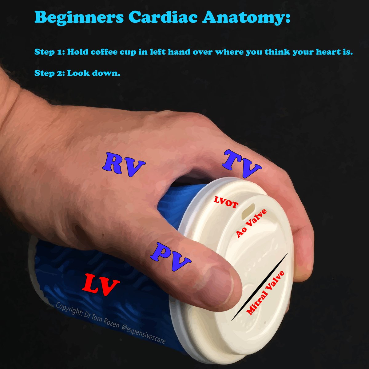 Coffee break teaching point: basic cardiac anatomy using a disposable coffee cup. #FOAMed #FOAMus #FOAMcc