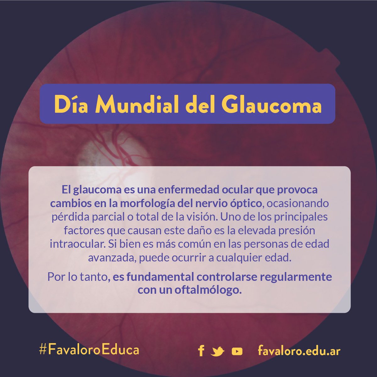 unifavaloro's tweet photo. 12 de marzo - Día Mundial del #Glaucoma
#Conciencia #Prevención
#FavaloroEduca https://t.co/tmCafruxYJ