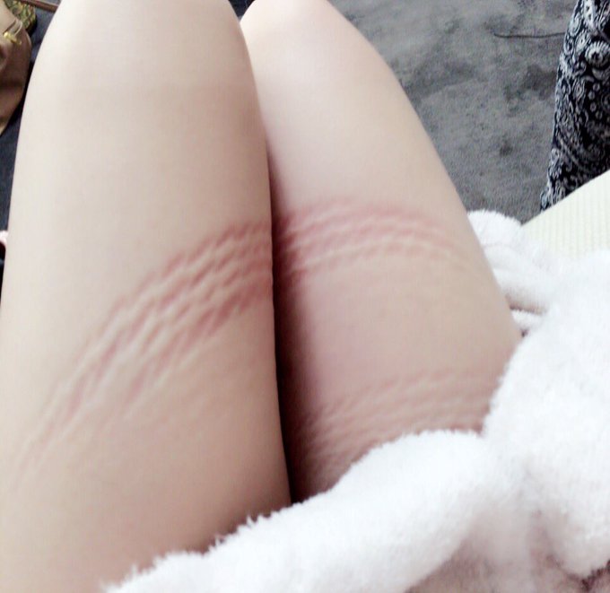 帰宅ーっ🦄💟✨ただいま  今月いっぱいSEXしてる💏 そろそろおまんこなくなる('･_･`)笑  明日も撮影はやく寝る🍌🍒 https://t.co/uX6UkHf58D<a href="/tag/%E6%9D%B1%E4%BA%AC%E5%96%B0%E7%A8%AE"class="tags"><span>#東京喰種</span></a>