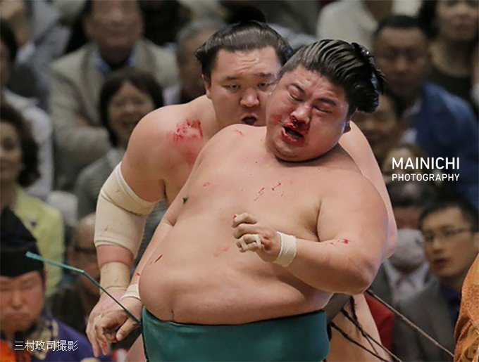 白鵬が嘉風を血祭り 井筒親方を病院送りという報道を受け 大した問題ではないが目くらまし的に盛り上げてみる件 ライブドアニュース