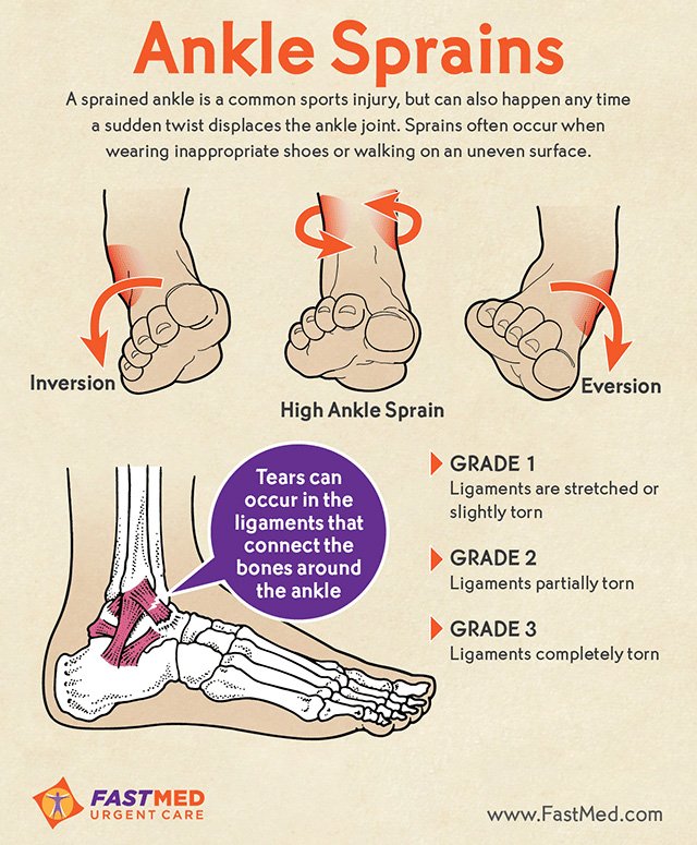 AHealthBlog's tweet image. A twisted ankle is the most common sports-related injury ➡ ahealthblog.com/0kyq
