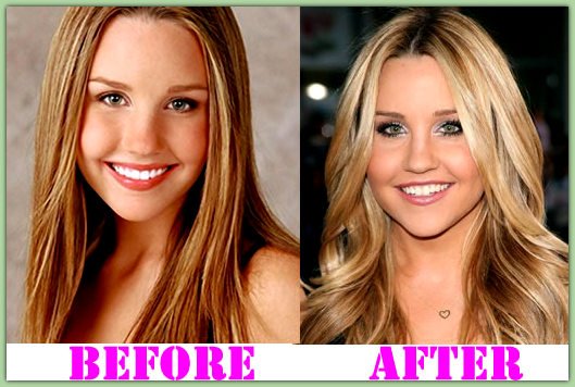 Amanda Bynes