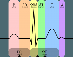 RewAU's tweet image. Revising acute coronary syndrome, 12 lead ECG and STEMI foamlinks.com/2016/03/acute-…