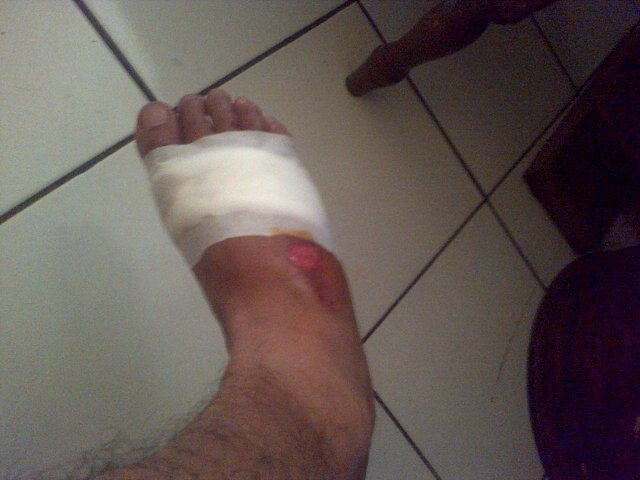 dihan_ardli's tweet photo. Masih cenat cenut https://t.co/fS08uLzkk3